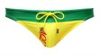 Photo3: Belt Bikinis "Yellow" (3)
